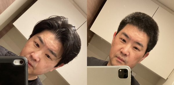 Before &#38; After